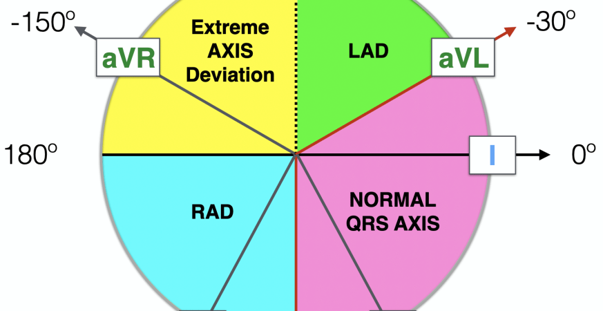 تفسیر محور قلب در نوار قلب (ECG Axis Interpretation)